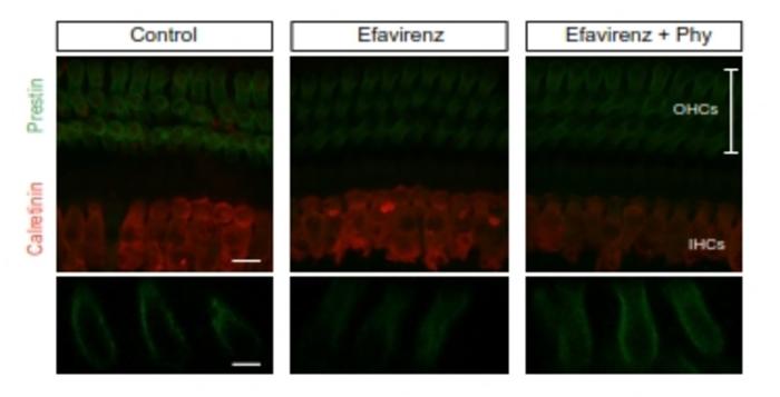 Prestin expression in OHCs from control, efavirenz, and efavirenz plus phytosterols-treated mice.

